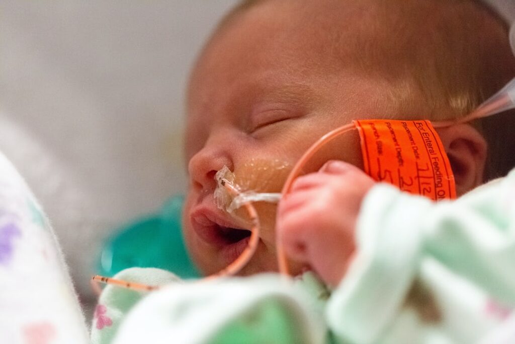 Preterm birth - Premature infant